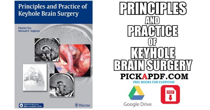Principles and Practice of Keyhole Brain Surgery PDF