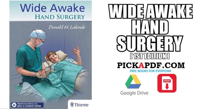 Wide Awake Hand Surgery PDF