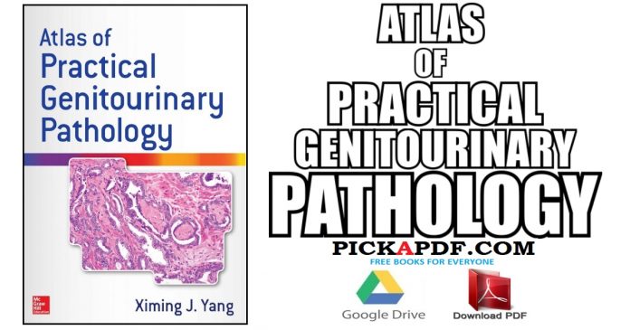 Atlas of Practical Genitourinary Pathology PDF