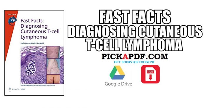 Diagnosing Cutaneous T-cell Lymphoma PDF