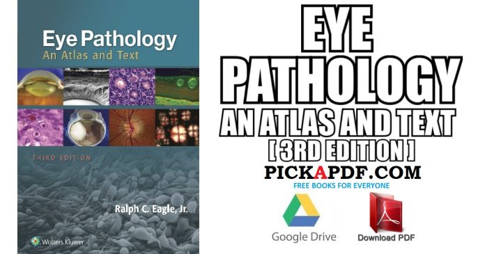 Eye Pathology An Atlas and Text PDF