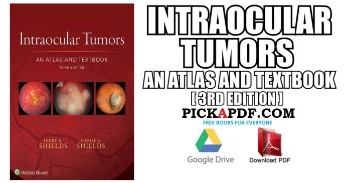 Intraocular Tumors An Atlas and Textbook PDF