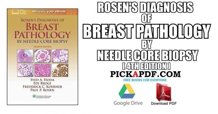 Rosen's Diagnosis of Breast Pathology by Needle Core Biopsy PDF