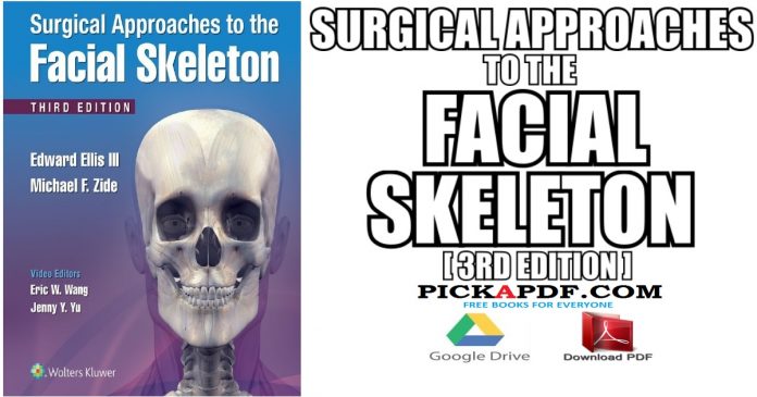 Surgical Approaches to the Facial Skeleton PDF