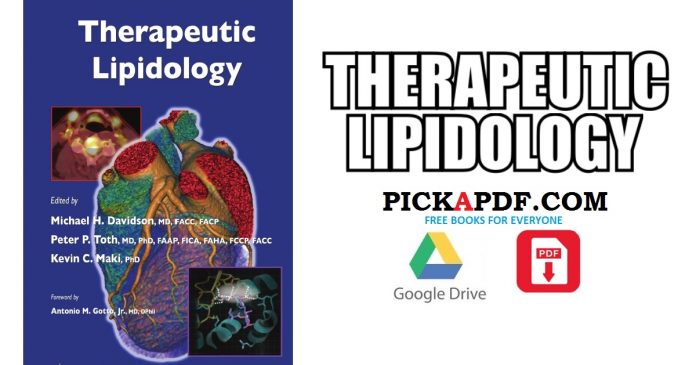 Therapeutic Lipidology PDF