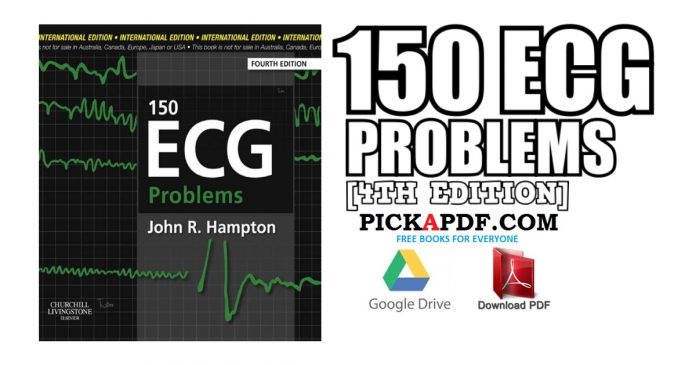 150 ECG Problems 4th Edition PDF