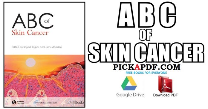 ABC of Skin Cancer PDF