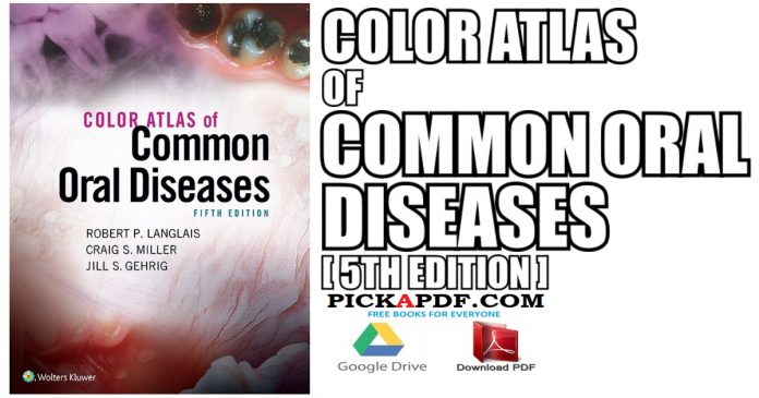 Color Atlas of Common Oral Diseases PDF