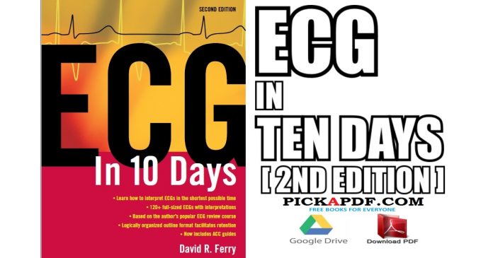 ECG in Ten Days 2nd Edition PDF