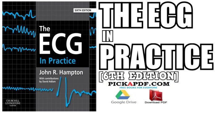 The ECG In Practice 6th Edition PDF