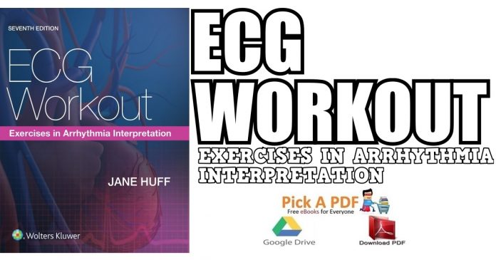ECG Workout: Exercises in Arrhythmia Interpretation 7th Edition PDF