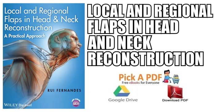 Local and Regional Flaps in Head and Neck Reconstruction PDF