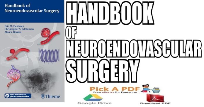 Handbook of Neuroendovascular Surgery PDF