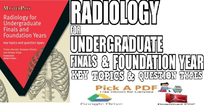 Radiology for Undergraduate Finals and Foundation Years PDF