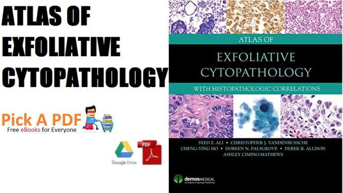 Atlas of Exfoliative Cytopathology With Histopathologic Correlations PDF Free Download