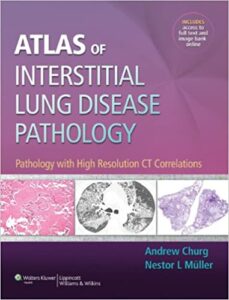 Atlas of Interstitial Lung Disease Pathology PDF