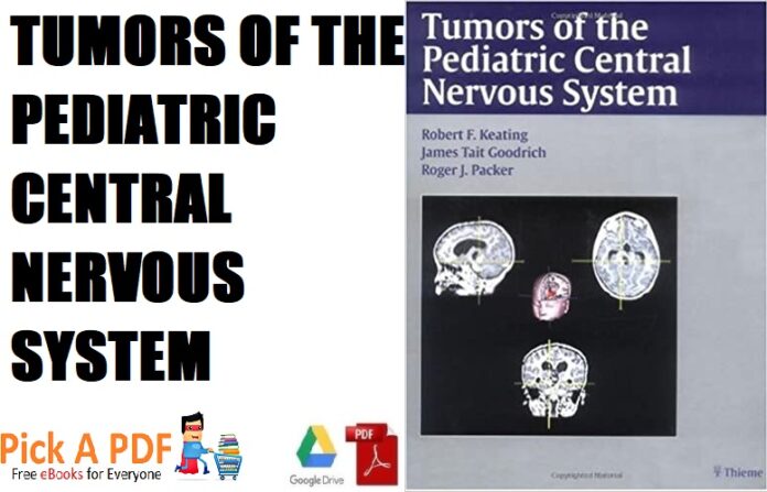 Tumors of the Pediatric Central Nervous System PDF Free Download